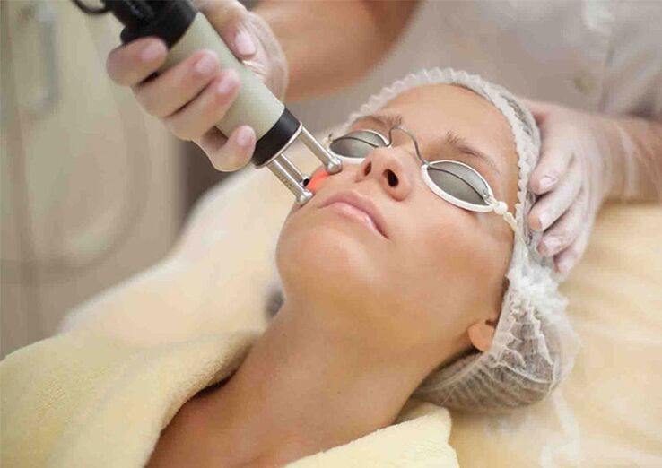 Лазерна процедура за подмладяване на кожата около очите